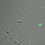 Porous Silica Nanoparticle 'Envelopes' Loaded With Compounds to Treat Infertility
