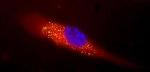 Nanosponge Vaccine More Effective Than Heat-Treated Staph Toxin Vaccines Against MRSA