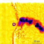 Researchers Collect First Direct Evidence Showing How Microbubbles Cause Blood Clot's Demise