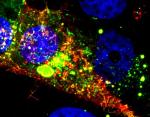 Researchers Characterize Respiratory Syncytial Virus Particle Using dSTORM Imaging