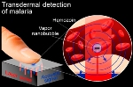 Researchers Develop Noninvasive Vapor Nanobubble Technology for Diagnosis of Malaria