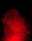 Scientists Inject Nanoparticles Carrying RNA Gene-Silencing Snippet to Treat Breast Cancer
