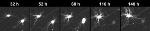 Lifespan of Individual Neurons Tracked with Robotic Microscope