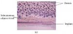 Nanodiamond-Silk Structures Help Study Drug-Cell Reaction
