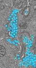 Caltech Researchers Use High-Resolution Electron Microscopy to Study HIV Infection in the Gut