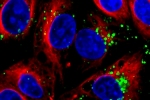 MIT Chemical Engineers Design Nanoparticles Capable of Silencing Disease-Causing Genes