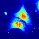 Nanodiffraction Enables Study of Living Biological Cells