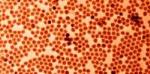 Uniform Antimony Nanocrystals Hold Promise for Batteries