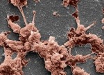 Synthetic Hydrogel May Help Natural Healing of Surgical Wounds by Promoting Blood Clotting