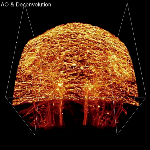 Adaptive Optics Microscopy Sharpens High-Resolution Images