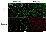 Cu-Cy Nanoparticles Exposed to X-rays Slow Tumor Growth