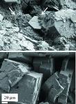 Crystallographic Techniques Help Understand Effects of Medical Treatment for Nanocrystal Cystine Kidney Stones