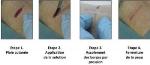 Aqueous Nanoparticle Solution Repairs Deep Wounds