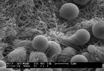 ‘Hemostatic Nanoparticles’ Injected After Blast Trauma Increases Survival Rates