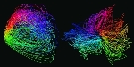 HHMI Thunder Tools Analyze Active Zebrafish Brain Images Taken with New Microscope
