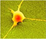 Researchers Analyze Role of Nanostructures Around Brain Cells