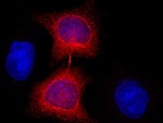 Nanobodies More Accessible for Research