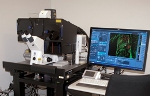 Super Resolution Microscopy Helps Observe Hitherto Unknown Structures Within Cells