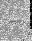 Wing Structure of Small Fly Inspires Nano-Patterned Surfaces That Resist Bacterial Adhesion