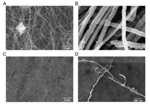 Nanoparticles Target Hard-to-Reach Cancers Without Causing Damaging Side Effects