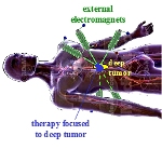 Fast Pulsed Magnetic Fields Help Focus Nano-Therapeutic Magnetic Particles to Deep Targets