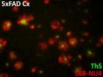 MRI Probe Pairs Magnetic Nanostructure with Antibody for Early Detection of Alzheimer's Disease