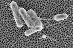Researchers Develop Nanoscale Surface which Prevents Bacterial Attachment