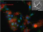 New 'Microcapsule' Treatment Delivery Method Could Reverse Tissue Damage Caused By Osteoarthritis