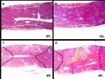 Electrolysis Combined with Reversible Electroporation for Minimally Invasive Tissue Ablation Surgery