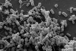 Intercellular Nanotubes Help Bacteria Exchange Nutrients