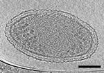 Cryo-Electron Tomography Reveals Internal Structure of Ultra-Small Bacteria