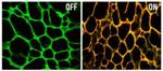 Novel Nanodevice Blocks Drug-Resistant Genes and Then Releases Cancer Drugs