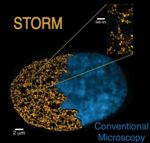 Super-Resolution Microscopy Helps Visualise and Count the Smallest Units in the Genome