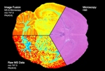 Phenomenal ‘Image Fusion’ of Mass Spectrometry and Microscopy