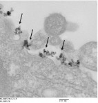 Iron Oxide Nanoparticles Selectively Target Tumor Cells