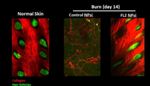 Researchers Develop Nanoparticle Therapy for Rapid Wound Healing