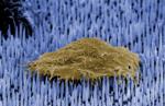 Tiny 'Nanoneedles' Prompt Parts of the Body to Generate New Blood Vessels