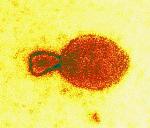 University of Queensland Antibody for Human Hendra Virus Clinical Trial