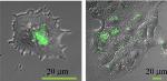 Systematic Study Analyzes Safety of Upconversion Nanoparticles to Treat Skin Cancer