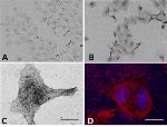 Gold Nanoparticles Tethered to pHLIPs Increase Effectiveness of Cancer-Killing Radiation