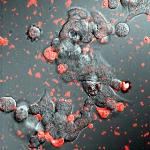 Exosomes Deliver Potent Antioxidant to the Brain to Treat Parkinson's Disease