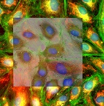 DELMIC Announces Workshop Hosted by Phenom World on Integrated CLEM to be Held on Wednesday June 24th at the Francis Crick Institute (Lincoln Inn Fields Laboratory)