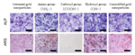 Functional Surfaces of Gold Nanoparticles Act on Osteogenic Differentiation of Stem Cells