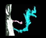 3D Nano-Architecture Image of Cells Around Damaged Area of the Heart