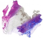 New Technique Uses Light and a Computer to Create Digital Pictures of a Tissue’s Chemical Composition