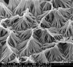 New Wirelessly Controlled Nanowire Implantable Drug-Delivery System