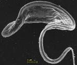 Encapsulated, Nanobody-Targeted Drugs Cold Help Treat Sleeping Sickness