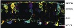 Cutting-Edge 3D Microscopy Helps Discover Thick Band of Microtubules in Certain Retina Neurons