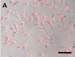 Hydrogel Coated Nanoshells Loaded with Chemotherapeutic Drugs are More Deadly to Tumors
