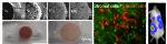 Integrated Microfluidic Chip Design with Embedded 3D Hydrogel Scaffold Can Help Capture Circulating Tumor Cells